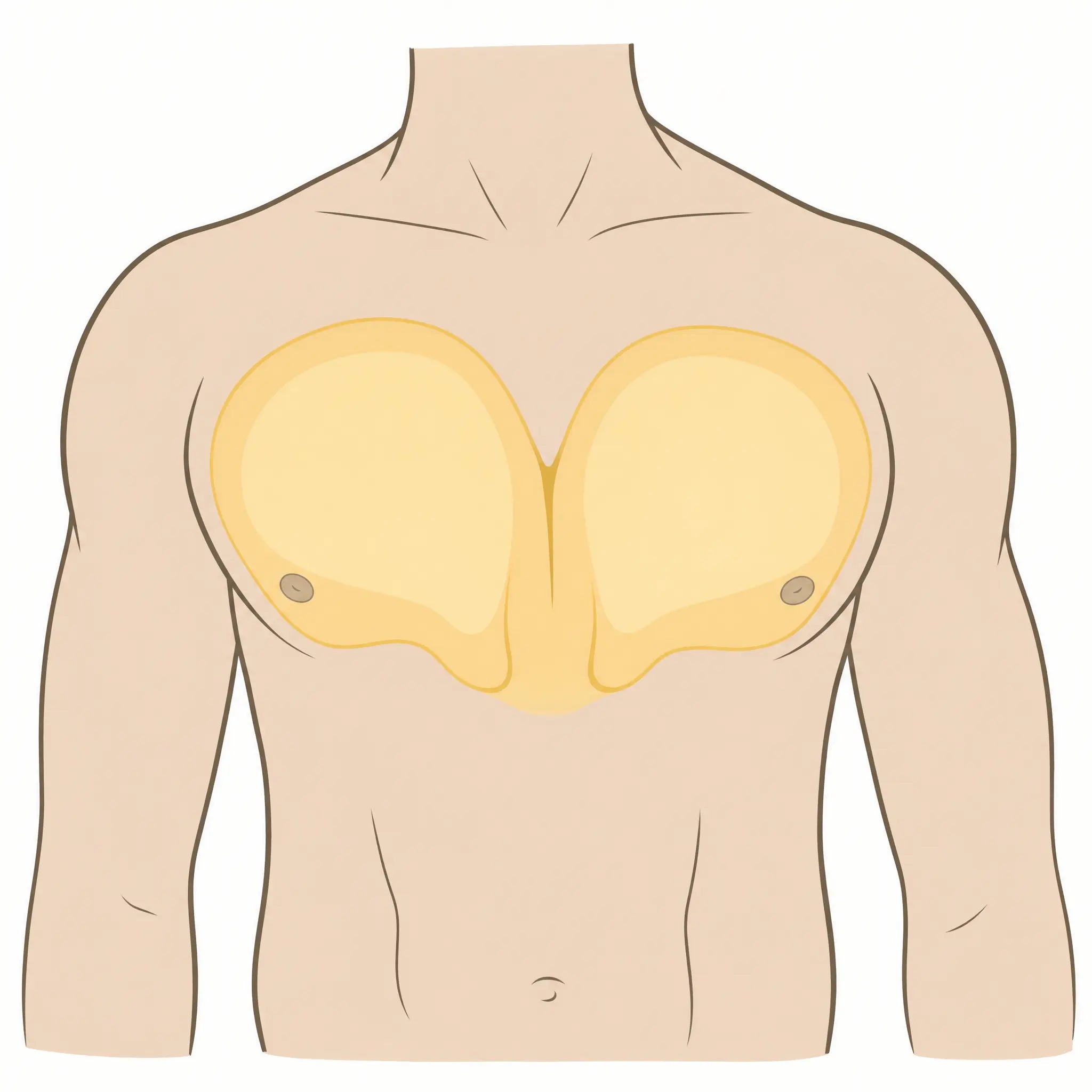 Representación de la acumulación de grasa sobre el músculo pectoral